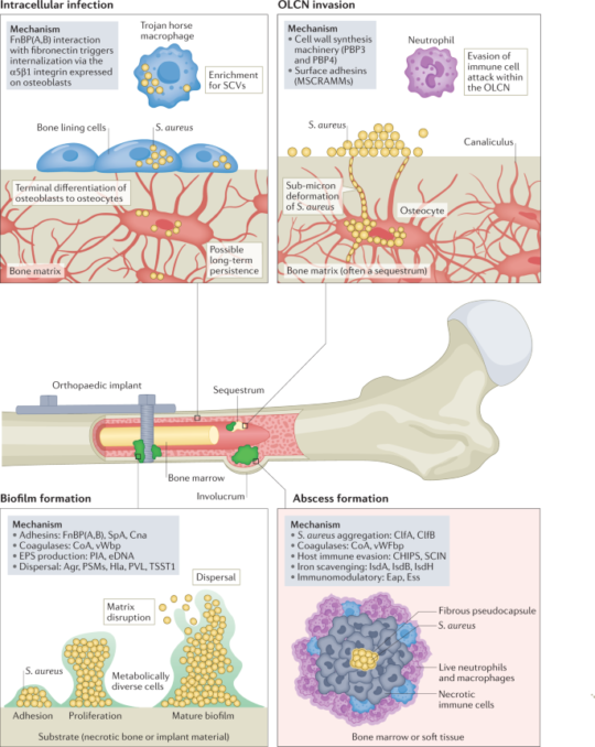 Role of Hyperbaric Oxygen Therapy (HBOT) in Osteomyelitis