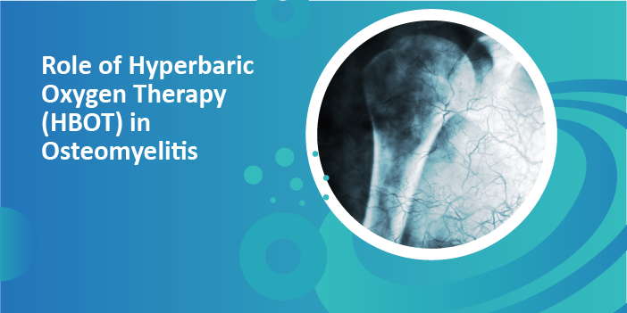 Role of Hyperbaric Oxygen Therapy (HBOT) in Osteomyelitis