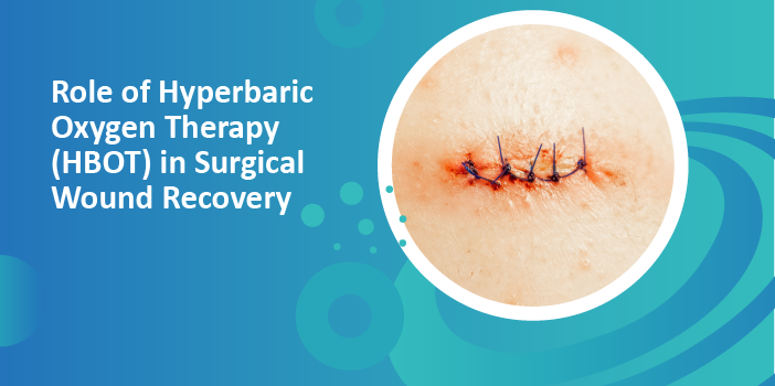 Role of Hyperbaric Oxygen Therapy or HBOT in Surgical Wound Recovery